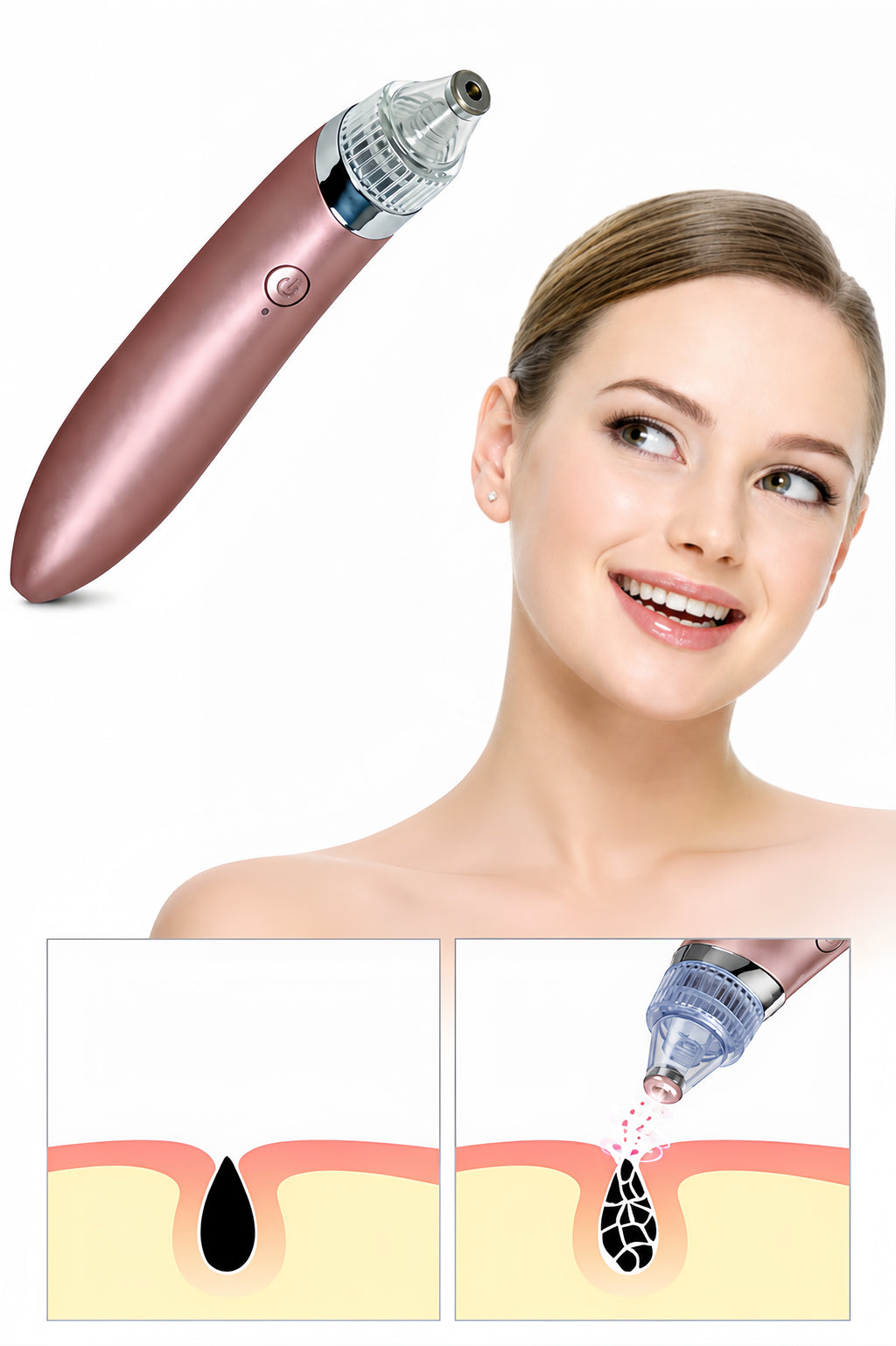 Rechargeable Blackhead Remover 5-in-1  & Electric Pore Vacuum Cleaner